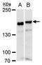 Rho Associated Coiled-Coil Containing Protein Kinase 1 antibody, TA308951, Origene, Western Blot image 
