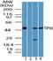 Histone acetyltransferase KAT5 antibody, TA337014, Origene, Western Blot image 