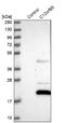 Chromosome 12 Open Reading Frame 65 antibody, NBP1-81934, Novus Biologicals, Western Blot image 