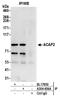 ArfGAP With Coiled-Coil, Ankyrin Repeat And PH Domains 2 antibody, A304-656A, Bethyl Labs, Immunoprecipitation image 