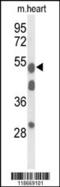 Alpha-1-B Glycoprotein antibody, 63-949, ProSci, Western Blot image 