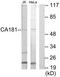 Zinc Finger HIT-Type Containing 6 antibody, TA315533, Origene, Western Blot image 