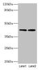 Lysosomal acid lipase/cholesteryl ester hydrolase antibody, LS-C285553, Lifespan Biosciences, Western Blot image 