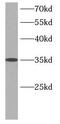 Twisted Gastrulation BMP Signaling Modulator 1 antibody, FNab09120, FineTest, Western Blot image 