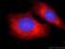 Dicer 1, Ribonuclease III antibody, 20567-1-AP, Proteintech Group, Immunofluorescence image 