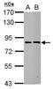 Epithelial Splicing Regulatory Protein 2 antibody, GTX123665, GeneTex, Western Blot image 