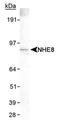 Solute Carrier Family 9 Member A8 antibody, MA1-46357, Invitrogen Antibodies, Western Blot image 