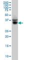 Solute Carrier Family 35 Member A3 antibody, MA5-21475, Invitrogen Antibodies, Western Blot image 