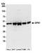 GPN-Loop GTPase 1 antibody, A304-614A, Bethyl Labs, Western Blot image 