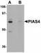 Protein Inhibitor Of Activated STAT 4 antibody, TA319932, Origene, Western Blot image 