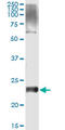 V-Set And Transmembrane Domain Containing 2 Like antibody, LS-C139209, Lifespan Biosciences, Immunoprecipitation image 