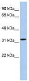 Cilia And Flagella Associated Protein 161 antibody, TA337777, Origene, Western Blot image 