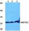 Acidic Nuclear Phosphoprotein 32 Family Member C antibody, A13313, Boster Biological Technology, Western Blot image 