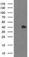 Monoglyceride Lipase antibody, TA502931, Origene, Western Blot image 