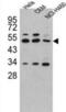 Carboxypeptidase A4 antibody, abx033337, Abbexa, Western Blot image 