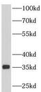 Pyruvate Dehydrogenase E1 Beta Subunit antibody, FNab06270, FineTest, Western Blot image 
