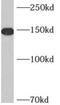 A-Kinase Anchoring Protein 1 antibody, FNab00249, FineTest, Western Blot image 
