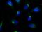 Golgin subfamily B member 1 antibody, GTX33924-13, GeneTex, Immunocytochemistry image 