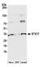 Syntaxin 17 antibody, A305-750A-M, Bethyl Labs, Western Blot image 