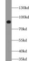 Uncharacterized protein C1orf103 antibody, FNab01057, FineTest, Western Blot image 