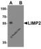 SCARB2 antibody, 4621, ProSci, Western Blot image 