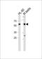 RAR-alpha antibody, MBS9212799, MyBioSource, Western Blot image 