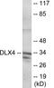 Distal-Less Homeobox 4 antibody, EKC1893, Boster Biological Technology, Western Blot image 