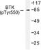 Bruton Tyrosine Kinase antibody, LS-C192176, Lifespan Biosciences, Western Blot image 