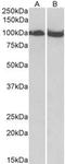 Clock Circadian Regulator antibody, TA320215, Origene, Western Blot image 