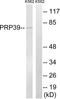 Pre-MRNA Processing Factor 39 antibody, LS-C120243, Lifespan Biosciences, Western Blot image 