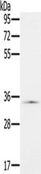 NADH:Ubiquinone Oxidoreductase Subunit A9 antibody, TA350205, Origene, Western Blot image 