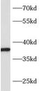 Solute Carrier Family 10 Member 2 antibody, FNab00626, FineTest, Western Blot image 