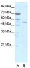 Homeobox even-skipped homolog protein 2 antibody, TA329728, Origene, Western Blot image 