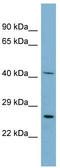 Mitochondrial Ribosomal Protein S2 antibody, TA345079, Origene, Western Blot image 