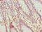 Serine Protease 35 antibody, LS-C399722, Lifespan Biosciences, Immunohistochemistry paraffin image 