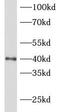 NK2 Homeobox 1 antibody, FNab09091, FineTest, Western Blot image 