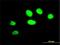 Zinc Finger Protein 207 antibody, H00007756-M01, Novus Biologicals, Immunofluorescence image 