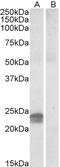 High mobility group protein HMG-I/HMG-Y antibody, EB09567, Everest Biotech, Western Blot image 