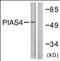 Protein Inhibitor Of Activated STAT 4 antibody, orb96012, Biorbyt, Western Blot image 