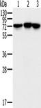 NADH:Ubiquinone Oxidoreductase Core Subunit S1 antibody, TA350216, Origene, Western Blot image 