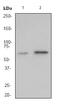WASP antibody, ab75830, Abcam, Western Blot image 