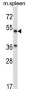 Abhydrolase Domain Containing 3 antibody, abx027632, Abbexa, Western Blot image 