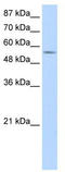DEAD-Box Helicase 47 antibody, TA344043, Origene, Western Blot image 