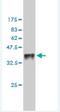 Testis Associated Actin Remodelling Kinase 1 antibody, H00007016-M01, Novus Biologicals, Western Blot image 