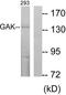 Cyclin G Associated Kinase antibody, TA313909, Origene, Western Blot image 