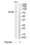 Glucuronidase Beta antibody, TA313989, Origene, Western Blot image 
