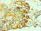 Calcitonin antibody, MBS1499953, MyBioSource, Immunohistochemistry paraffin image 