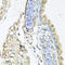 Cathepsin K antibody, 18-119, ProSci, Immunohistochemistry frozen image 