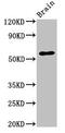 Solute Carrier Family 32 Member 1 antibody, CSB-PA863984LA01HU, Cusabio, Western Blot image 