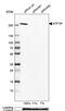 Activating Transcription Factor 7 Interacting Protein antibody, PA5-54811, Invitrogen Antibodies, Western Blot image 